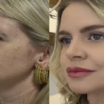 Estética regenerativa: o novo luxo além dos preenchedores