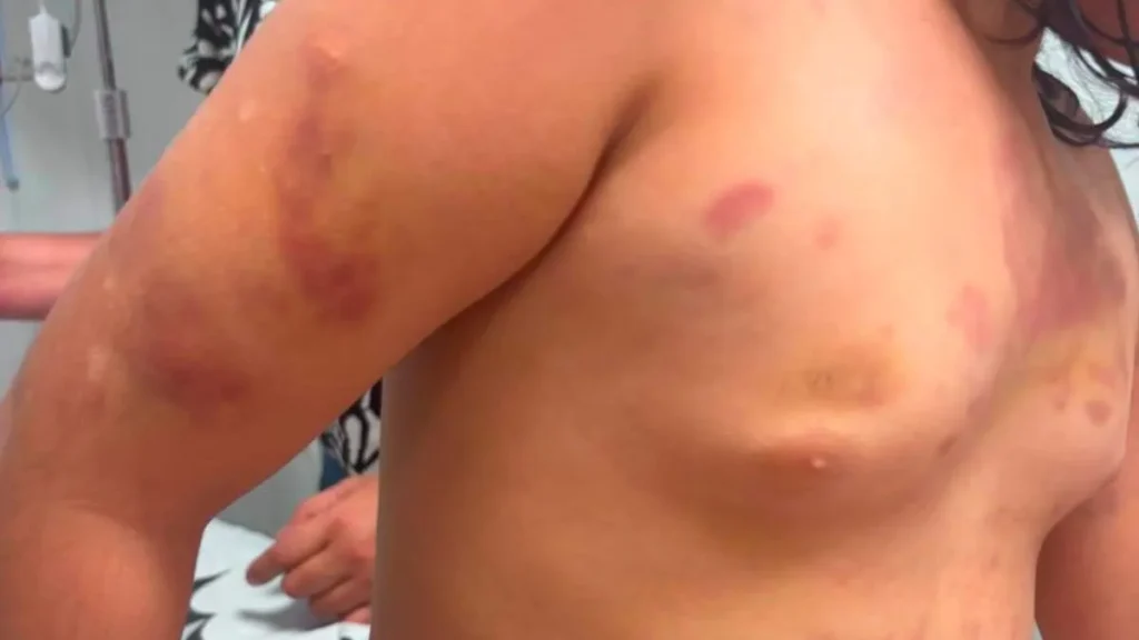 Padrasto é preso por agredir menina autista de 6 anos