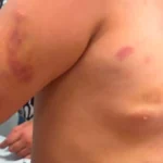 Padrasto é preso por agredir menina autista de 6 anos