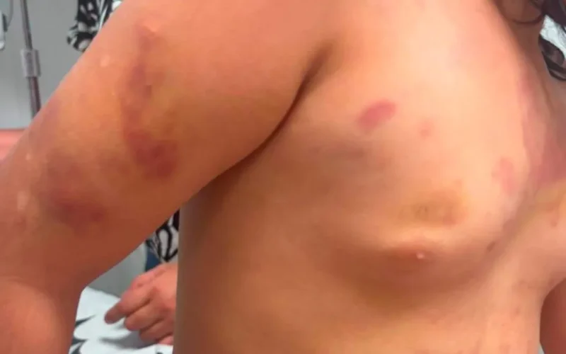 Padrasto é preso por agredir menina autista de 6 anos
