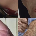 Idoso de 87 anos é atacado por cão na Vila Nasser