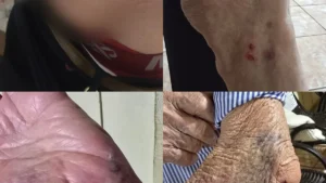 Idoso de 87 anos é atacado por cão na Vila Nasser