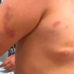 Mãe de menina autista agredida diz que padrasto era “figura de pai”