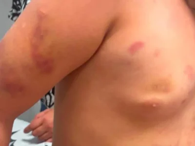 Mãe de menina autista agredida diz que padrasto era “figura de pai”